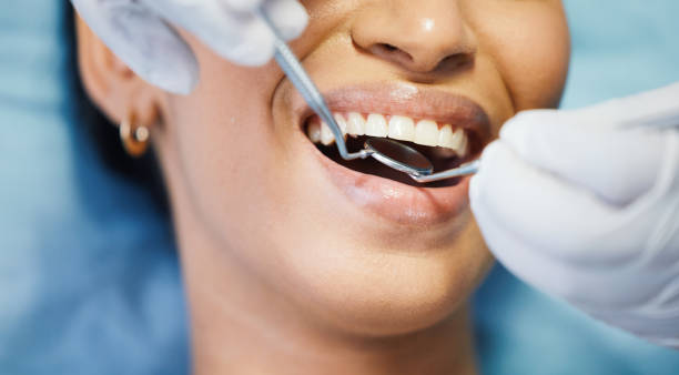 Best Orthodontic Emergency Dentist in Tye, TX