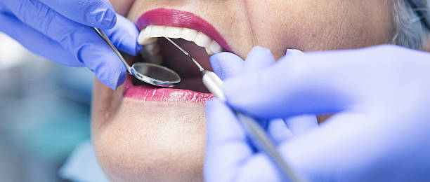 Best Emergency Dentist for Knocked-Out Tooth in Tye, TX