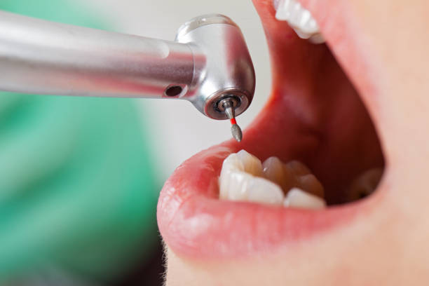Best Weekend Emergency Dentist in Tye, TX